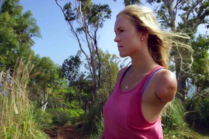 A woman wearing a pink singlet top stands on the side, showing her left arm is missing.